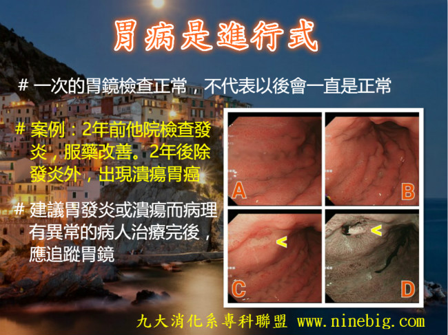 胃病是進行式105.8S